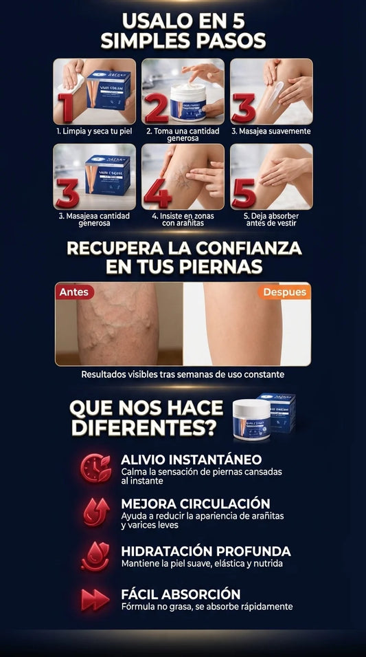 varices